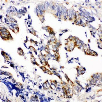 Beta Arrestin 2/ARRB2 Antibody