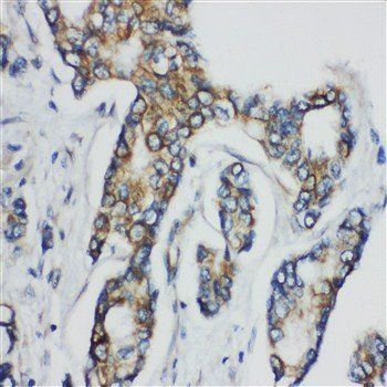Anti-CD1d Antibody
