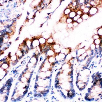 Anti-Fatty Acid Binding Protein 5/FABP5 Antibody