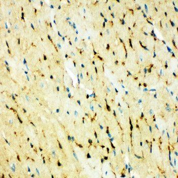 Anti-Fatty Acid Binding Protein 5/FABP5 Antibody