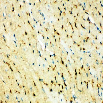 Fatty Acid Binding Protein 5/FABP5 Antibody