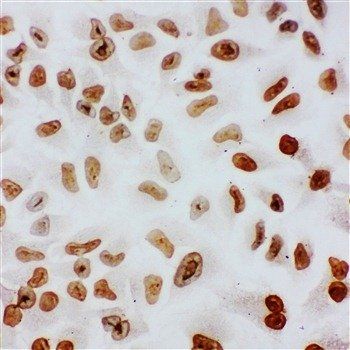 Anti-splicing factor 1/SF1 Antibody