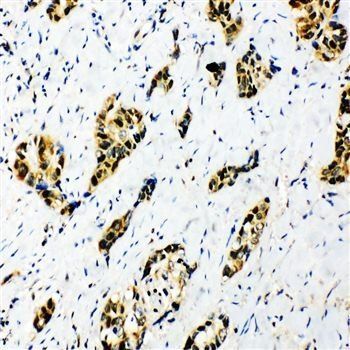 splicing factor 1/SF1 Antibody