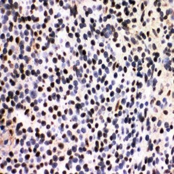 Anti-splicing factor 1/SF1 Antibody