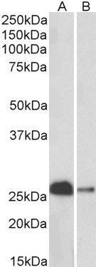 Goat anti-calbindin D28 Antibody