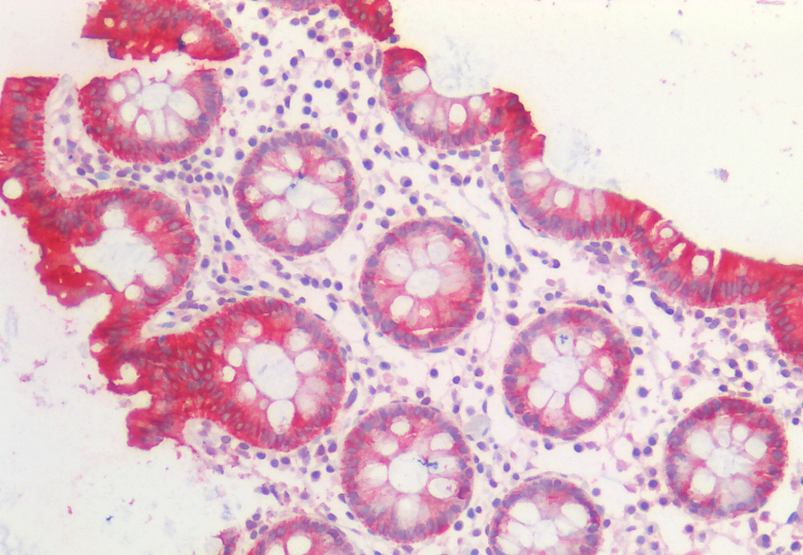Goat anti-Cytokeratin 20 Antibody
