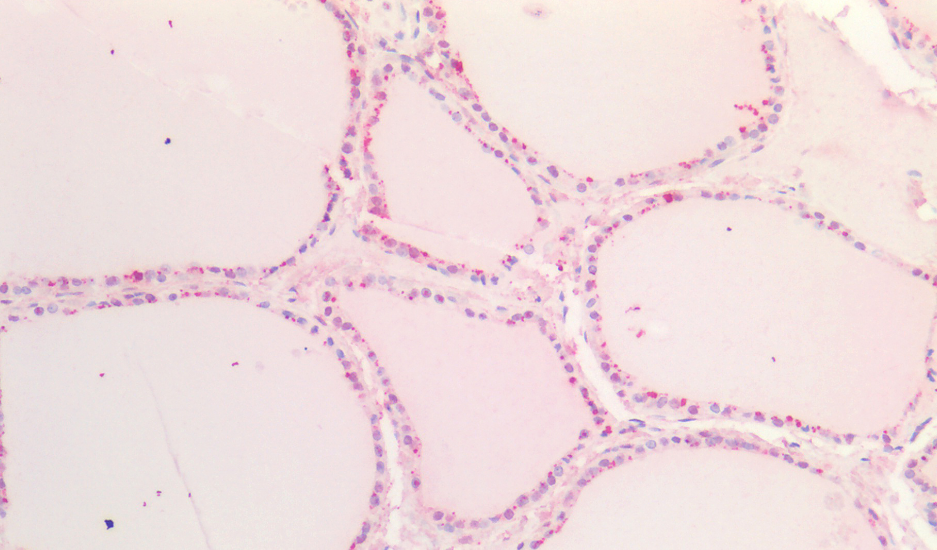 Sox9b (zebrafish aa5-18) Antibody