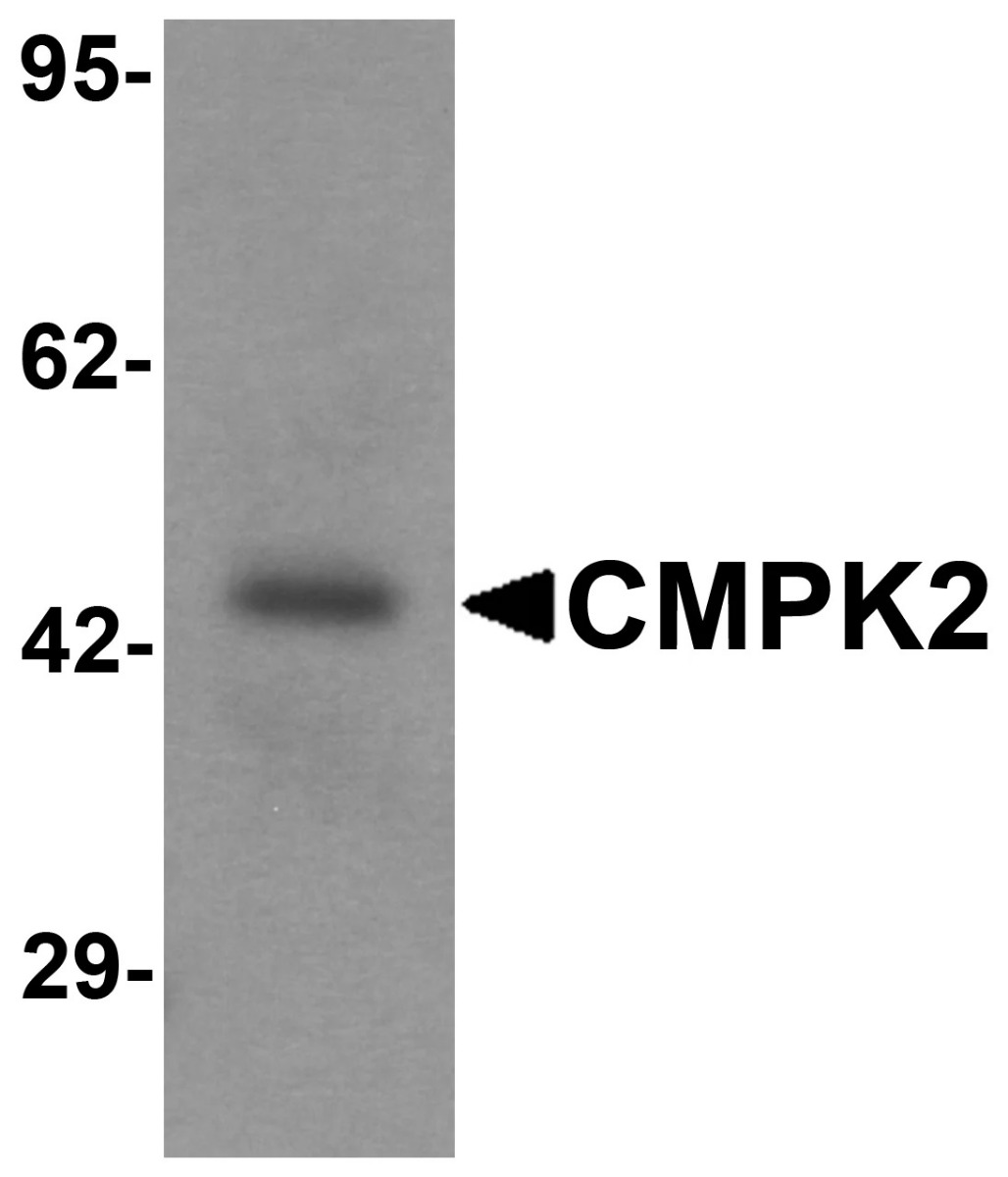 CMPK2 Antibody