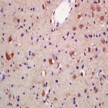 HSD17B3 Rabbit Polyclonal Antibody (PE)
