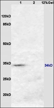 HSD17B3 Rabbit Polyclonal Antibody (PE)