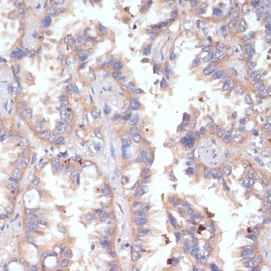 CD47 Antibody