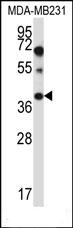 PTPLA Antibody