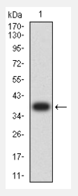 CCR10 antibody