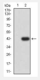 CCR10 antibody