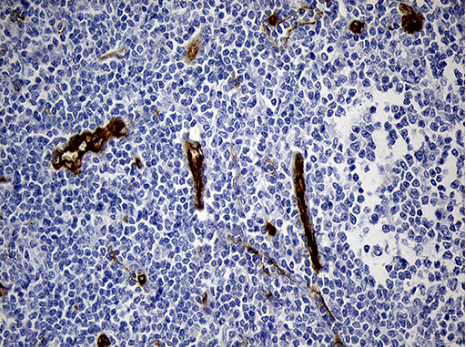 TM4SF2 Antibody