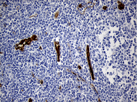 TM4SF2 (TSPAN7) antibody