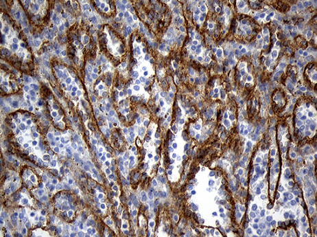 TM4SF2 Antibody