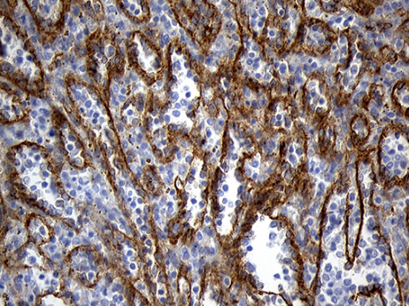 TM4SF2 (TSPAN7) antibody