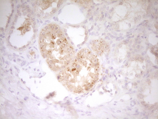 IL12B Antibody