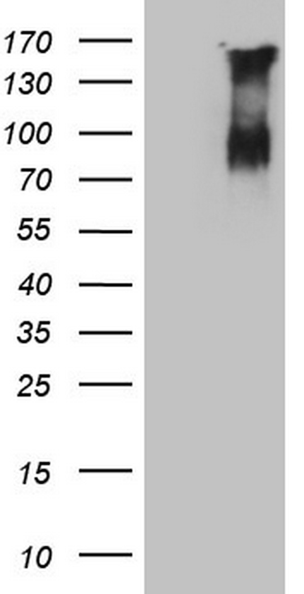 Factor XIII Antibody