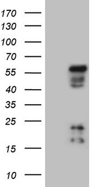NR2E3 Antibody