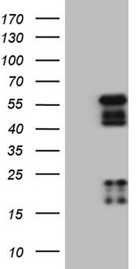 NR2E3 Antibody