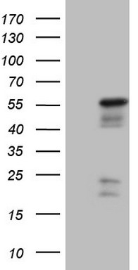 NR2E3 Antibody