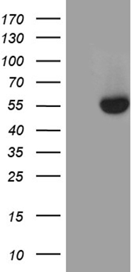 Steroidogenic Factor 1 Antibody