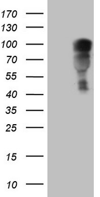 Glucocorticoid Receptor Antibody