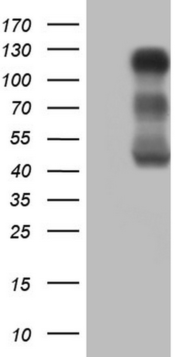 Lipin 1 Antibody