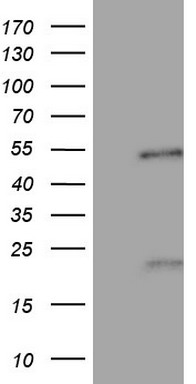 Steroidogenic Factor 1 Antibody