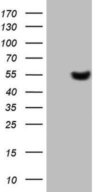 DNAAF11 Antibody