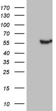 DNAAF11 Antibody