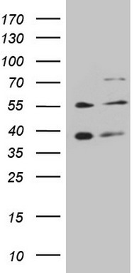 GRK4 Antibody