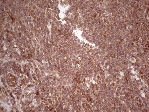 Laminin 5 Antibody