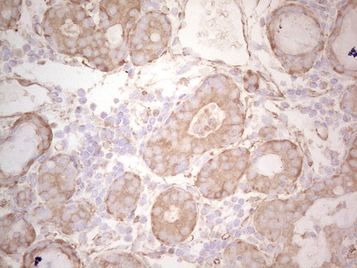 Ephrin A3 Antibody