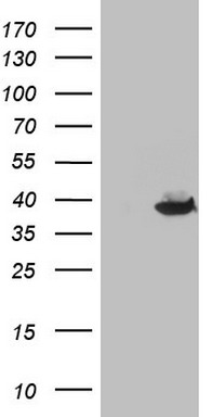 THTPA Antibody