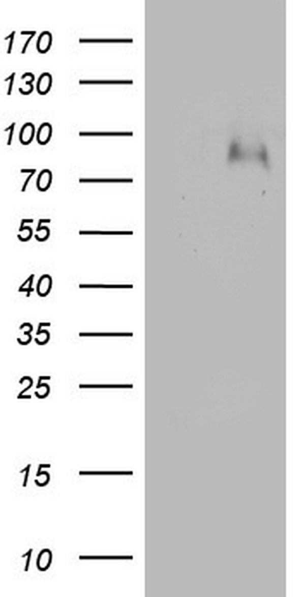 Factor XIII Antibody