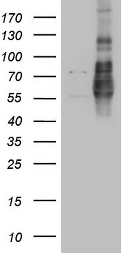 LPIN1 Antibody