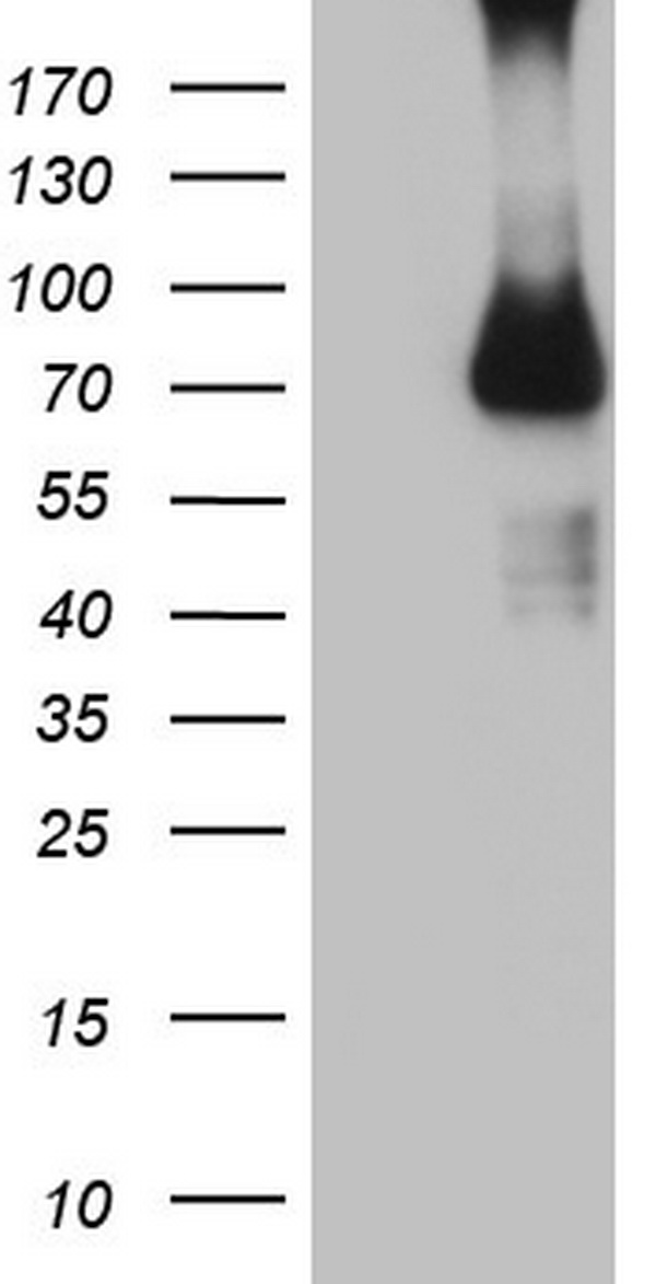 Factor I Antibody