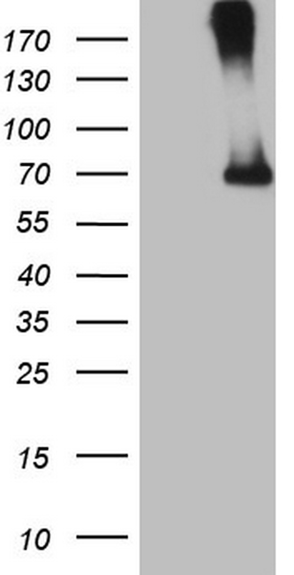 Factor I Antibody