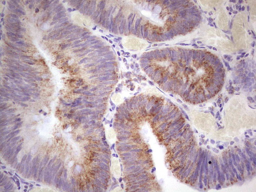 MARK3 Antibody