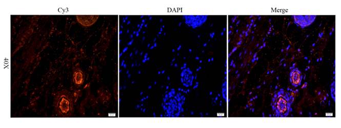 CD163 antibody