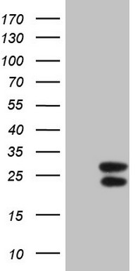 IFNG Antibody