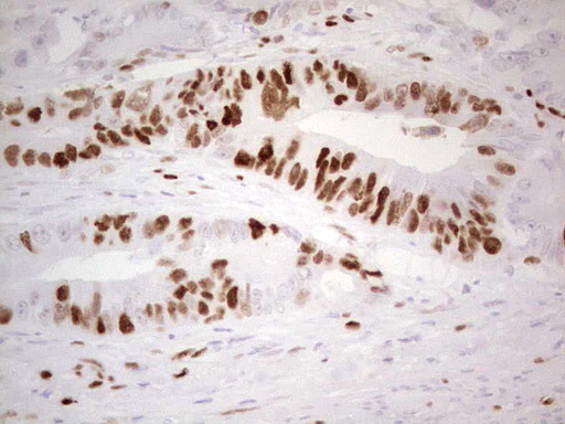 MCM2 Antibody