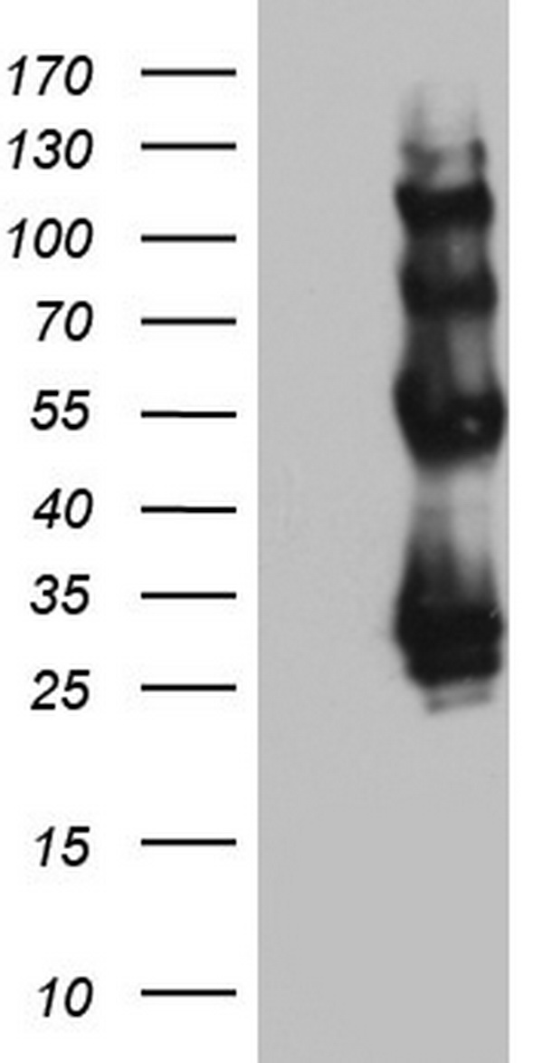 PROCR Antibody