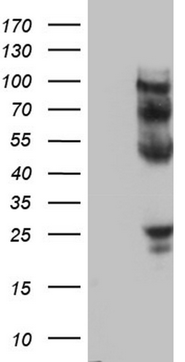 PROCR Antibody
