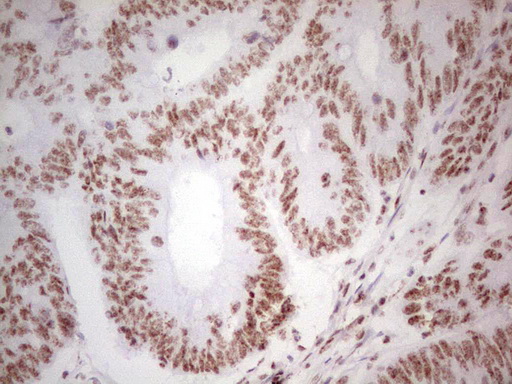 ALKBH1 Antibody