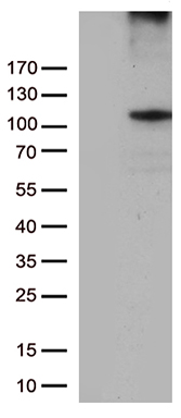 Rb Antibody
