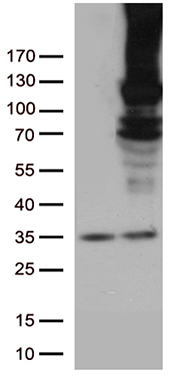 RB1 Antibody